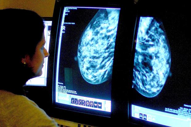 57% of Scots women'do not check regularly for breast cancer symptoms