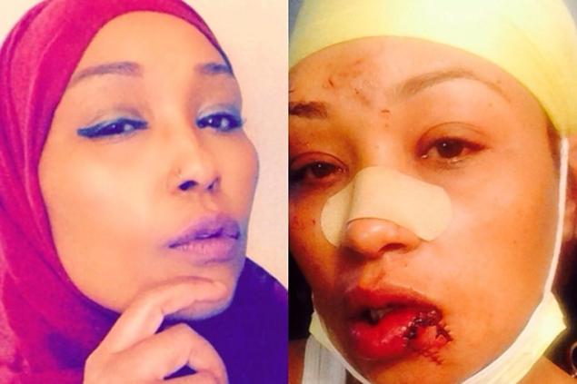 Group calls for hate crime charges in attack on Swahili-speaking woman