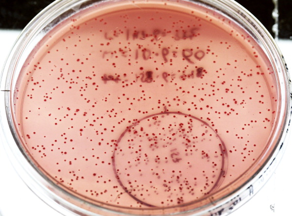Grown E. Coli Bacteria