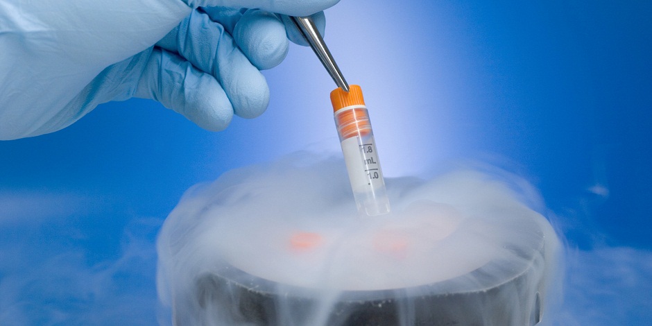 Cryopreservation