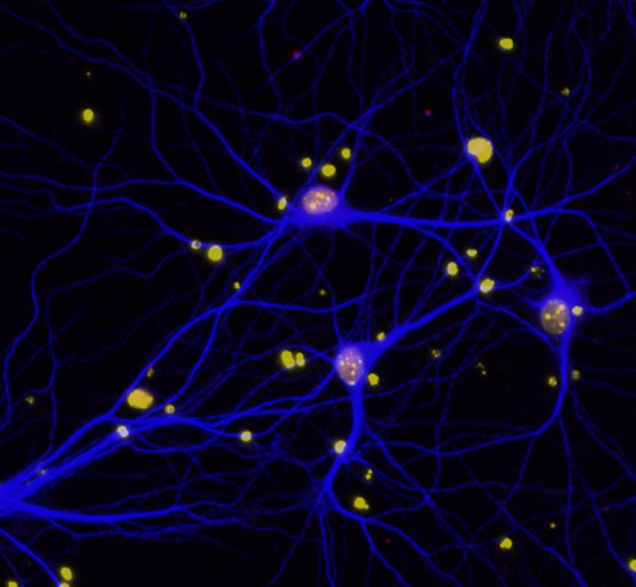 Scientists reduced levels of BRCA1 in mouse brains and in neurons in a dish to investigate the role of the protein in dementia