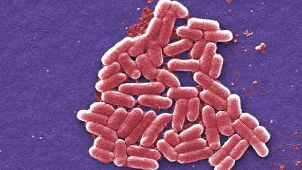 E. Coli