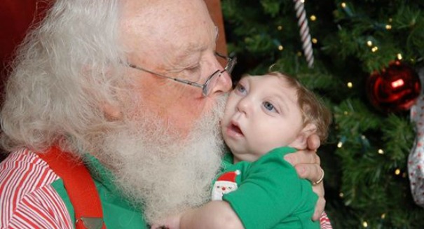 Holiday miracle Baby with partially developed brain pays a visit to Santa