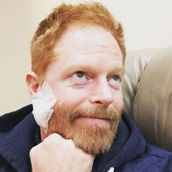 Jesse Tyler Ferguson reveals he had cancer removed from his face in Instagram snap