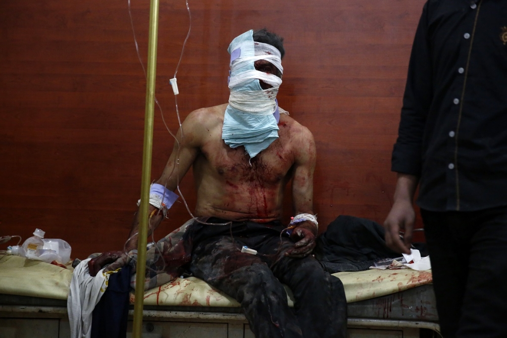 A man wounded in an air strike by Syrian government forces on Hammuriyeh in the rebel-held region of Eastern Ghouta,on the outskirts of the Syrian capital Damascus sits in a field hospital