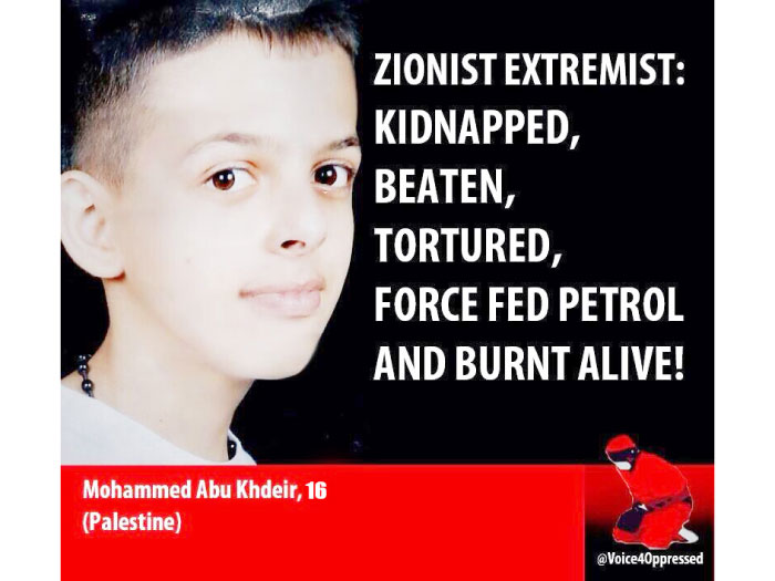 Mohammed Abu Khdeir 16 was abducted and killed