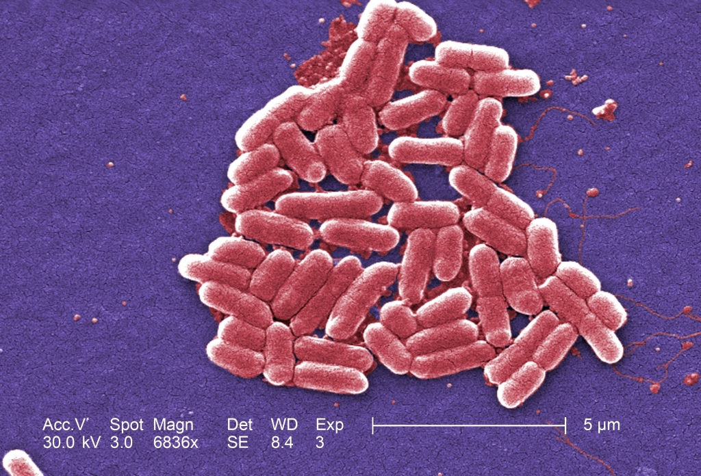 This colorized scanning electron micrograph depicts a number of Escherichia coli bacteria of the strain O157:H7. This strain of E. coli is an emerging cause of foodborne illness