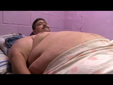 Andres Moreno died of a heart attack and inflammation of the abdominal lining early Christmas Day barely two months after undergoing weight-loss surgery. – You Tube screenshot