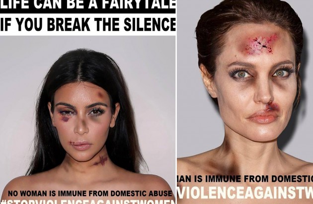 Artist imagines celebrities as victims of domestic abuse