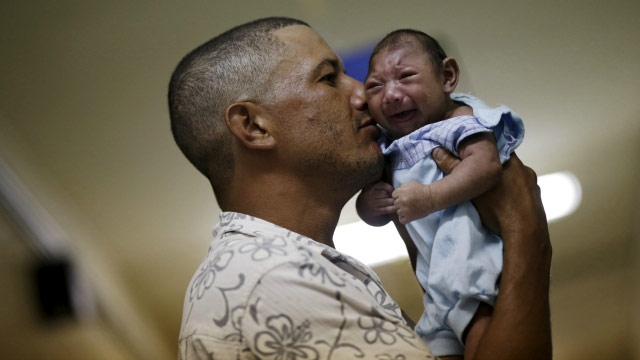 Caught off-guard by Zika Brazil struggles with deformed babies