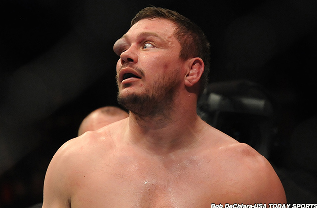 UFC Fight Night 81 Matt Mitrione’s Eye Permanently Damaged