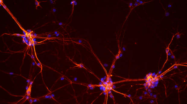 Neurons from a mouse spinal cordFLICKR NICHD  S. JEONG