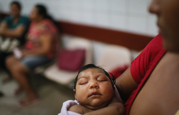 A Brazilian baby with microcephaly, thought to be caused by a Zika infection in her mother during pregnancy