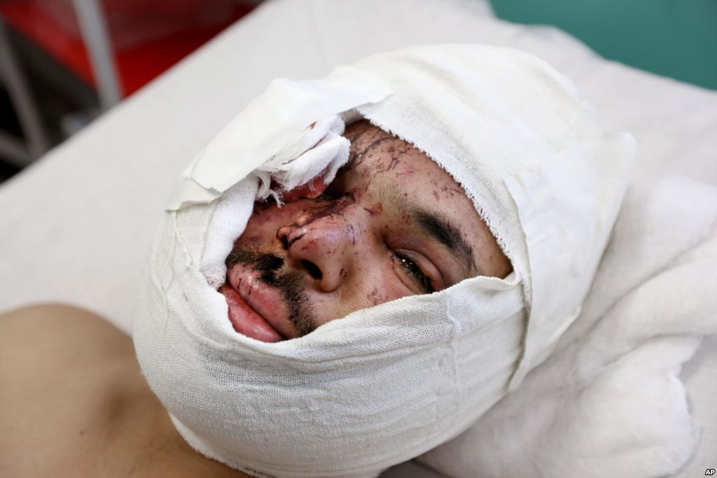 Hasib Sadat an Afghan journalist injured from yesterday's suicide attack near the Russian Embassy lays on a bed at a hospital in Kabul Afghanistan Jan. 21 2016