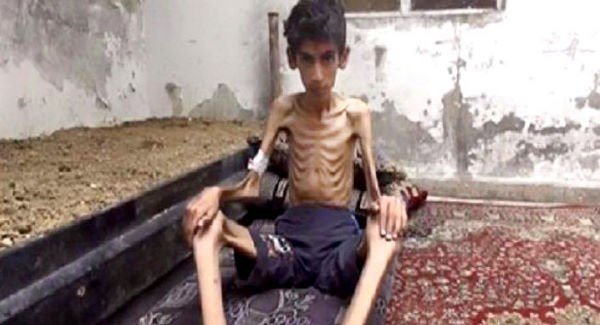 Syria: Five More Starvation Deaths in Madaya Since Humanitarian Convoy Arrival