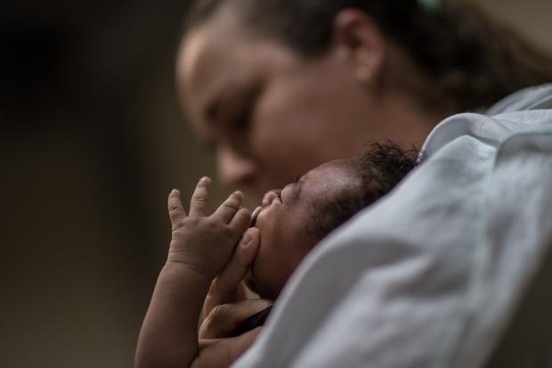 A physiotherapist in Brazil holds a baby suffering from microcephalia