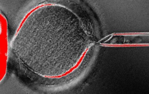 Britain approves gene-editing experiments on human embryos