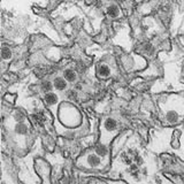 FILE- This January 2016 microscope image provided by the Centers for Disease Control and Prevention shows the Zika virus. On Tuesday Feb. 23 2016 the CDC