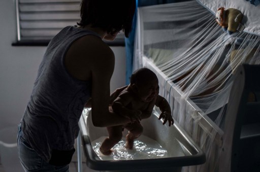 28 2016 shows Kleisse Marcelina,24 bathes her son Pietro 2 month suffering from microcephalia caught through an Aedes Aegypti mosquito bite in Salvador Brazil on January 28, 2016.  AFP  CHRISTOPHE SIMON