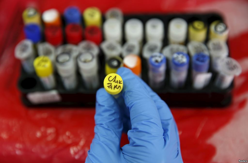 FILE- A health technician shows a blood sample from a patient bitten by a mosquito at the National Institute of Health in Lima Peru Feb. 2 2016