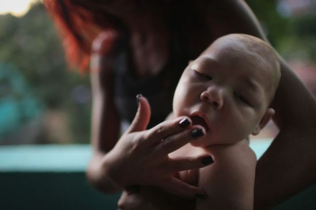 More than 4000 babies have been affected in Brazil leading to them being born with underdeveloped brains and 'shrunken heads&#x27