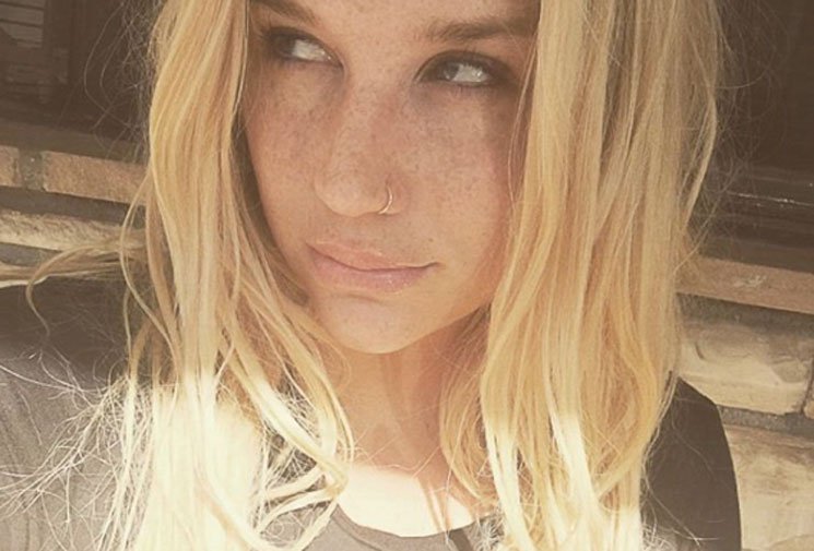 Kesha's Bid for Release from Dr. Luke Contract Denied Following Abuse Allegations