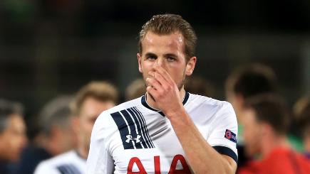 Harry Kane injured his nose in Sunday's FA Cup tie