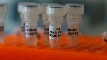 Texas reports first case in the USA of sexually transmitted Zika virus