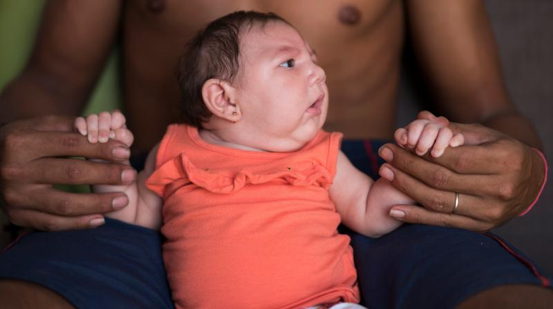 Researchers would likely be able to prove more quickly that Zika causes Guillain Barre than microcephaly