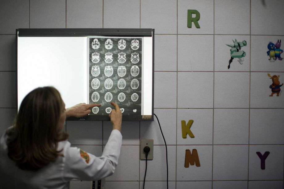 Doctor Angela Rocha shows brain scans of a baby born with microcephaly at the Oswaldo Cruz Hospital in Recife Brazil Thursday Jan. 28 2016. Brazilian officials still say they believe there's a sharp increase in cases of microcephaly and strongly suspe