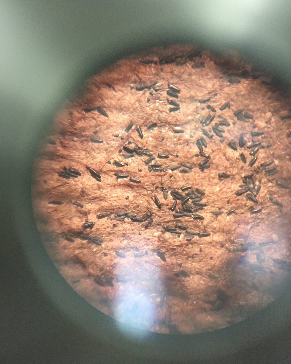 Eggs of the aedes aegypti seen through a microscope. The mosquito lays its eggs in stagnant waters in populated areas making public awareness one of the main tools of fighting against the epidemic