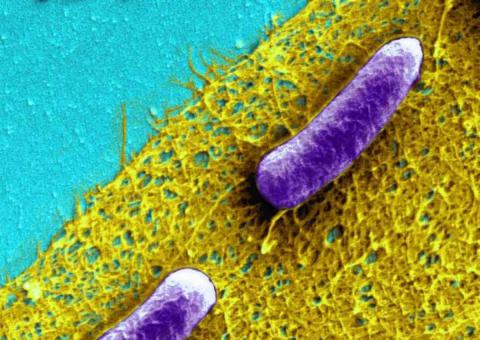 Bacteria Resistant To Last Resort Antibiotics Discovered In United States