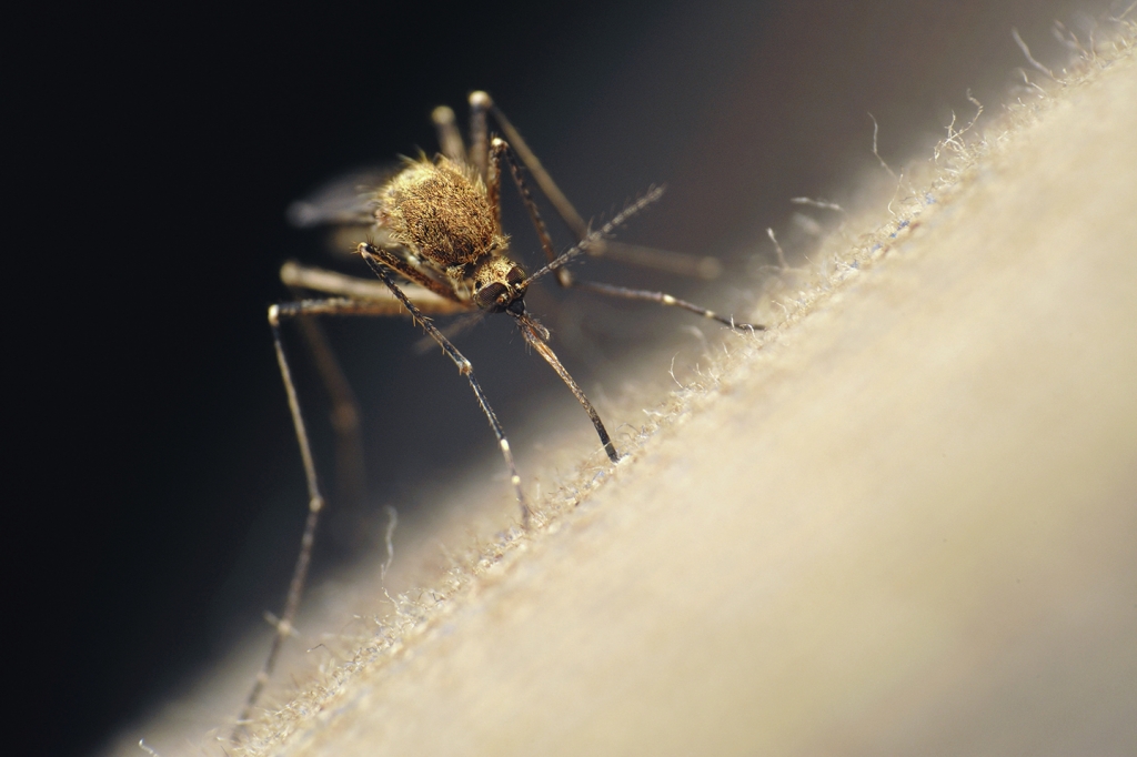 New Jersey doc: Baby born to mom with Zika looks 'affected'