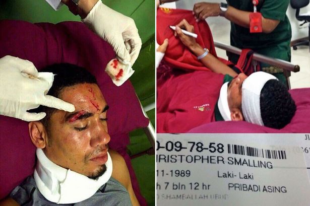 Chris Smalling's summer is now, officially shit after holiday accident in Bali