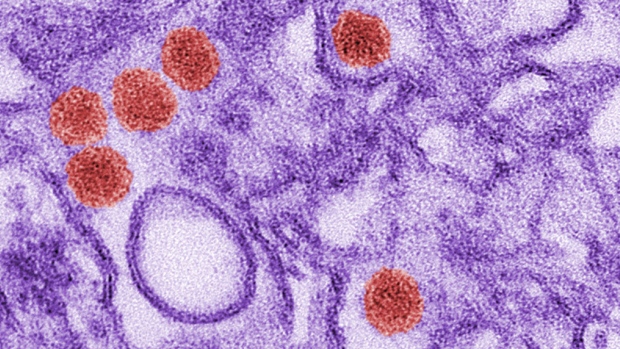 This is a digitally-colourized transmission electron micrograph of Zika virus