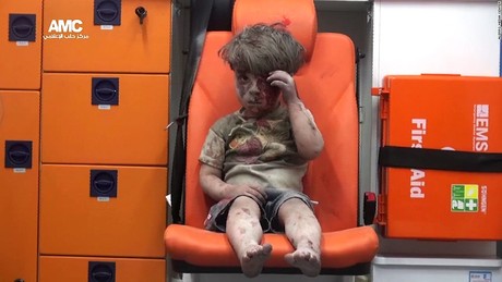 Image of Aleppo boy shocks world; Russia offers cease-fires