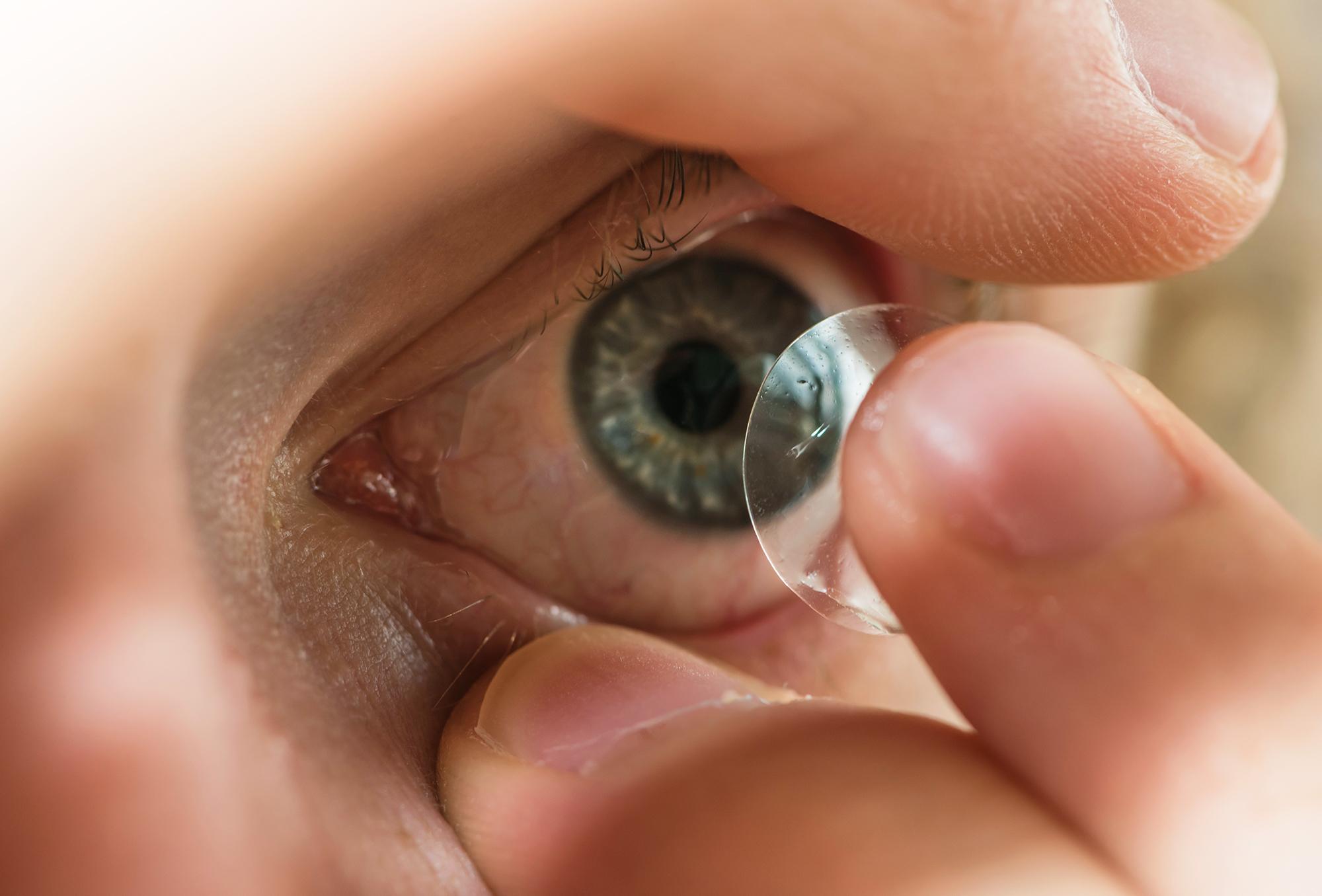 Contact lenses are simple and convenient but also medical devices