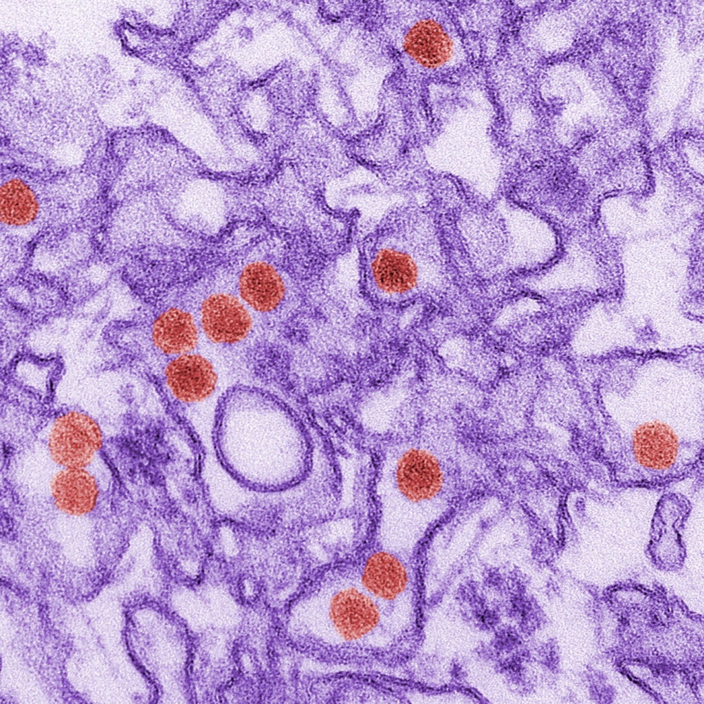 A transmission electron micrograph of the Zika virus