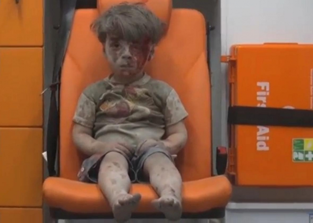 Haunting image of Syrian boy rescued from Aleppo rubble