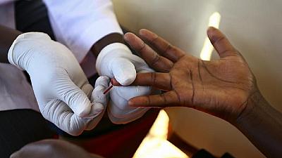 Facts about AIDS infection and prevention efforts