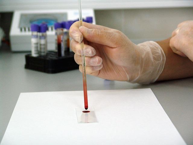 Simple blood test might predict onset of Alzheimer's