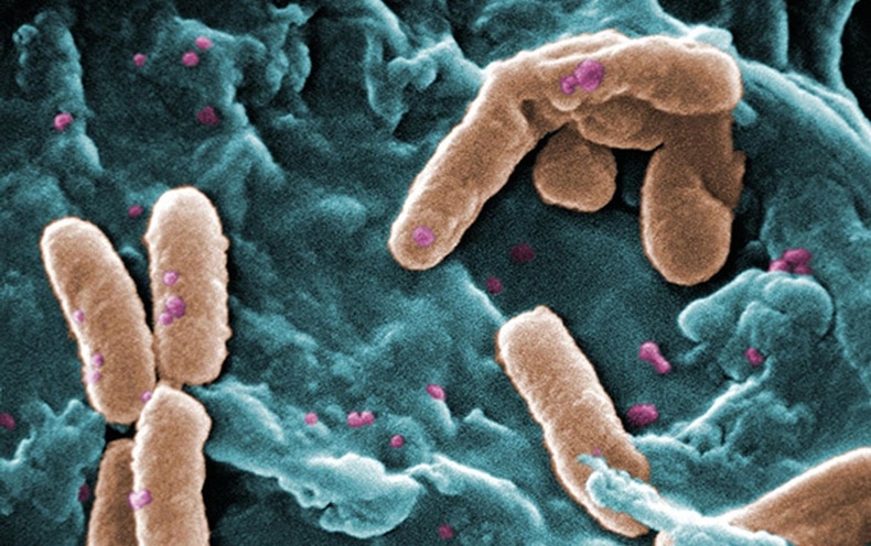 Pseudomonas aeruginosa is one bacterium on the WHO's list of highest priority needs for new antibiotics. Credit CDC Wikimedia