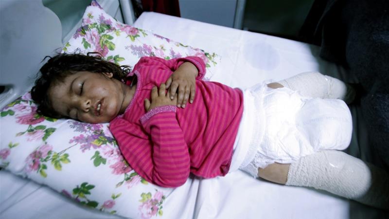 Dima Nadm Hamid 3 years old is treated for possible exposure to chemical weapons agents